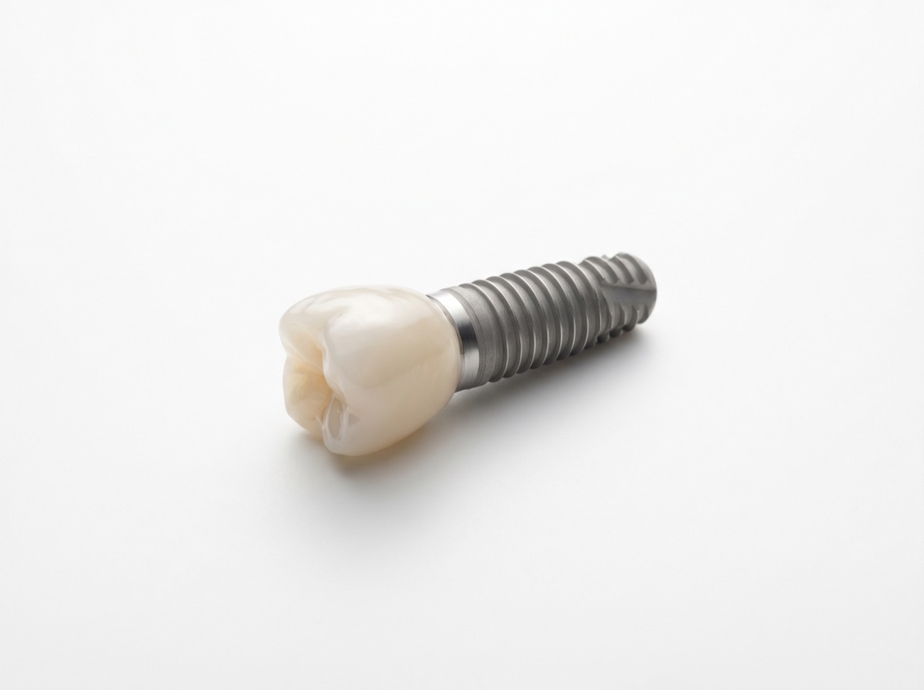 Dental implants